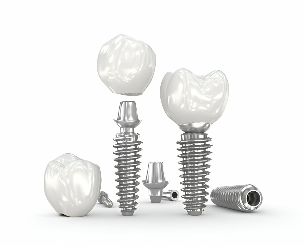 dental Implant Aberdeen